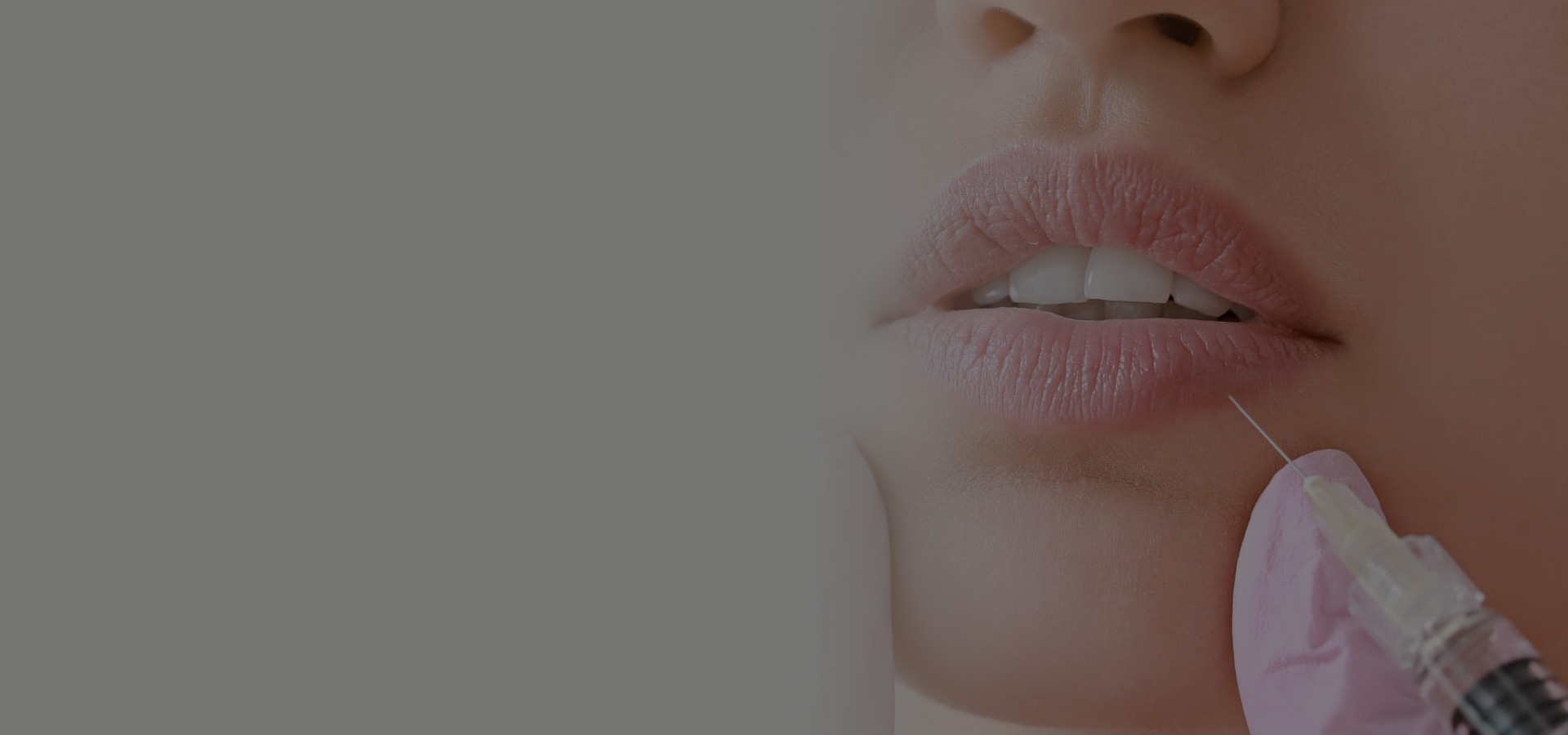 parallax background